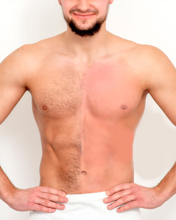 depilacao-masculina-na-mooca